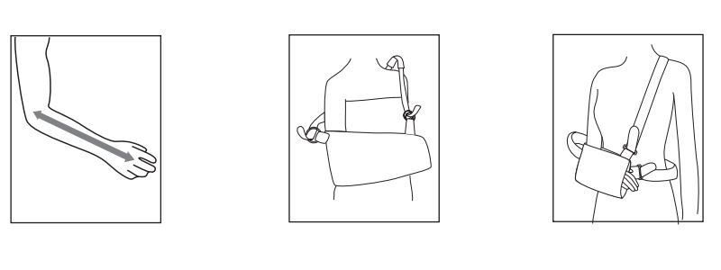 Instructions for Use The Arm and Shoulder Sling